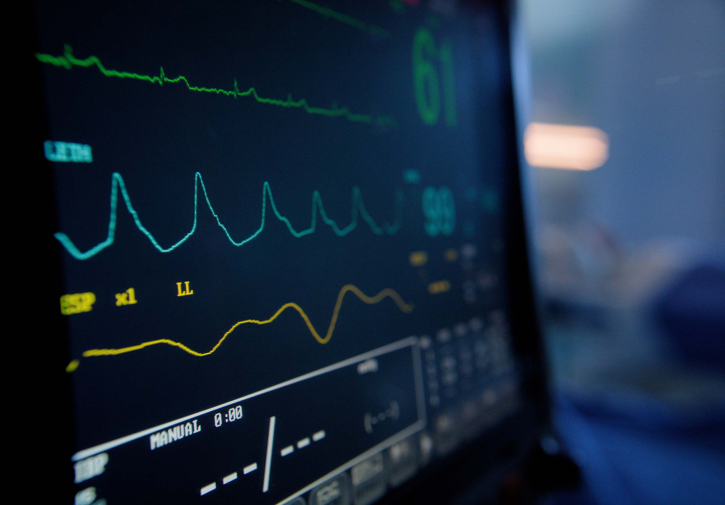 ecg machine